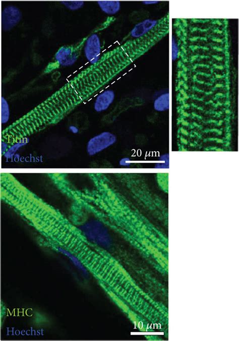 Derivation Of Skeletal Myocytes And Matured Myotubes From Human IPSCs