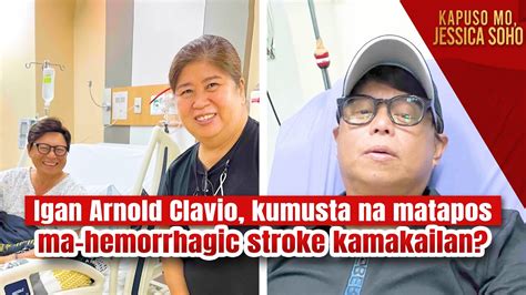 Igan Arnold Clavio Kumusta Na Matapos Ma Hemorrhagic Stroke Kamakailan