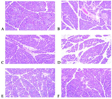 He Staining Observation Of Rat Pancreas Pathology ×100 A Con B