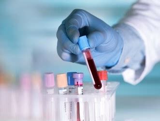 Prealbumin Blood Test - Creative Diagnostics