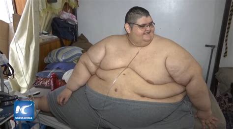 El Hombre Más Gordo Del Mundo Ya Bajó 218 Kilos Y Ahora Sueña Con