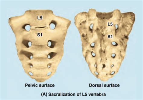 Embryology Bone Pathology Physiology Msk Exam Flashcards Quizlet