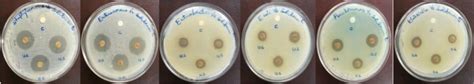 Plates Of Disc Diffusion Assay Showing Antibacterial Activity Of G