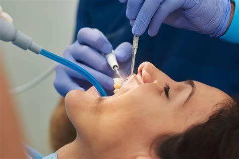 10 Most Common Dental Procedures And How They Work