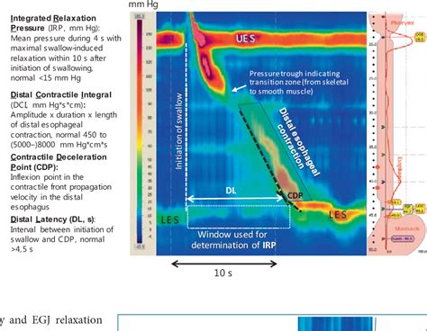 Figure 1 From What Is The Impact Of High Resolution Manometry In The