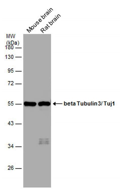 beta-3 Tubulin Antibody (PA5-85609)