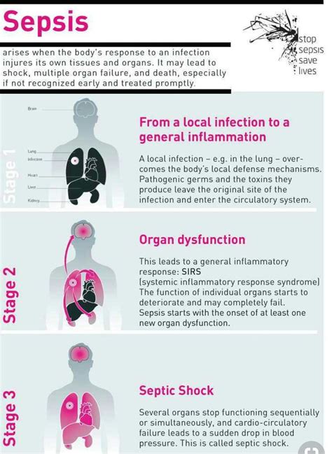 Sepsis Infection Edelhard Verlin