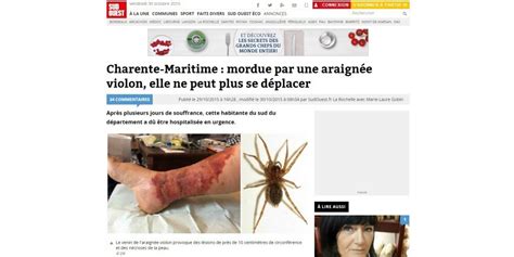 France - Santé . Charente-Maritime : mordue par une araignée, sa jambe ...