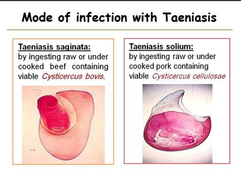 Taenia Saginata Cysticercus Bovis