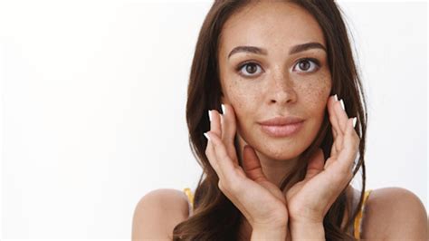 Understanding Melasma: Causes, Symptoms, and Treatment