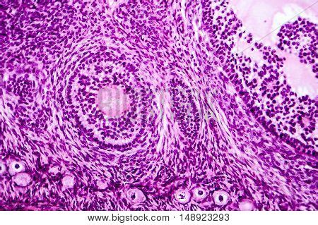 Light Micrograph Ovary Image Photo Free Trial Bigstock