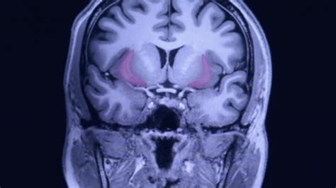 How Do Psychedelics Work This Brain Region May Explain Their Effects