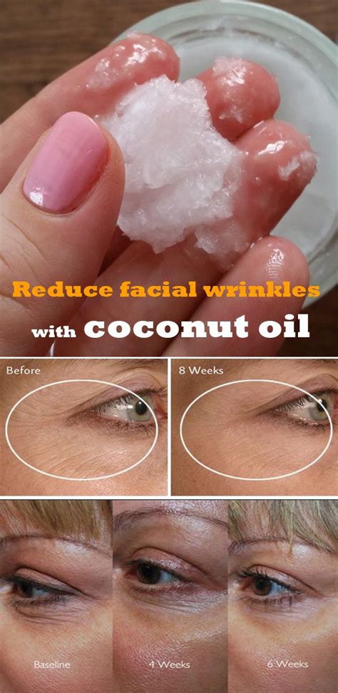 Reduce Facial Wrinkles With Coconut Oil Health And Diy Ideas