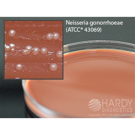 Hardy Diagnostic E30 Dry Culture Media Thayer Martin Mod Agar Plate