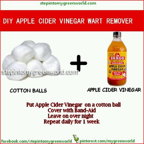 Vinegar Wart Treatment