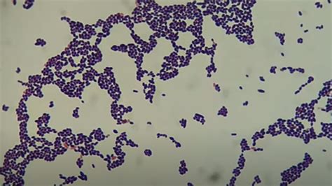 Enterococcus Faecalis Gram Stain