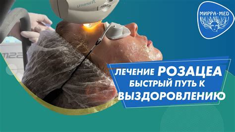 Розацеа, сосуды, сеточки на лице. Самая эффективная методика лечения ...