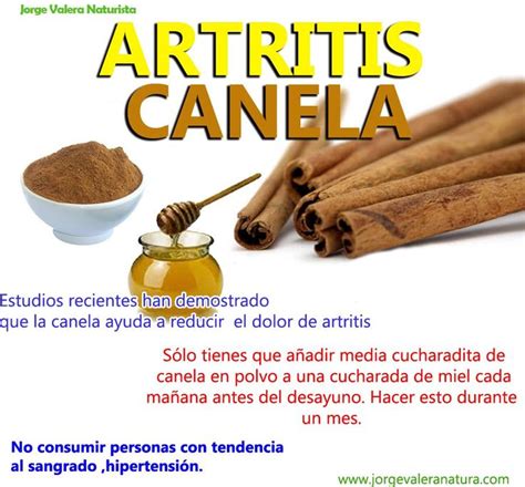 Remedio Natural Con Canela Para La Artritis Infografías Y Remedios