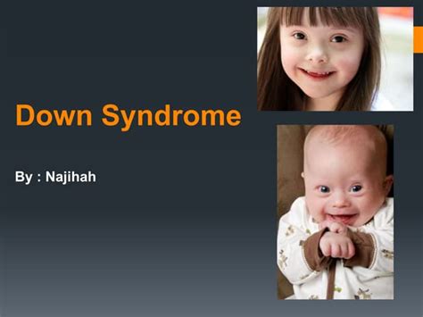 Down Syndrome Ppt