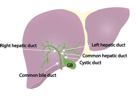 Biliary Obstruction Double Barrel Sign Monkey Puzzle Sign Critical