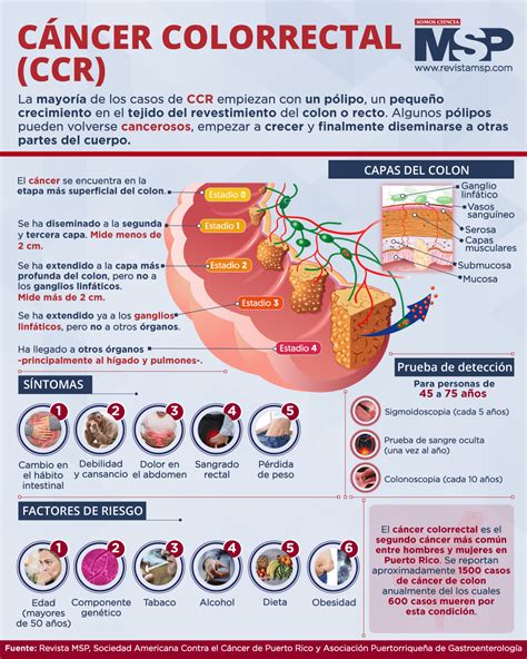 Cáncer colorrectal Infografía