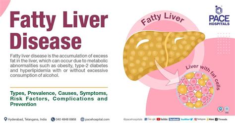 Fatty Liver - Symptoms, Grade, Causes, Complications, Prevention