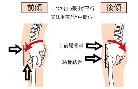 骨盤の正しい位置と腹圧を高める効果：筋肉と姿勢への影響を解説 姿勢とボディメイクを考える