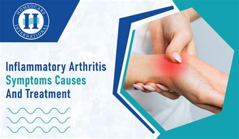 Inflammatory arthritis symptoms causes and treatment ‣ Arthritis | Homeocare International