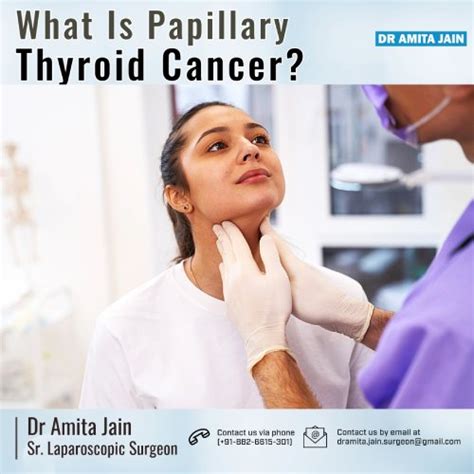 What Is Papillary Thyroid Cancer? By Dr Amita Jain