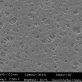 SEM Picture Of The Commercial PES Membrane Magnification Of 4 00 KX