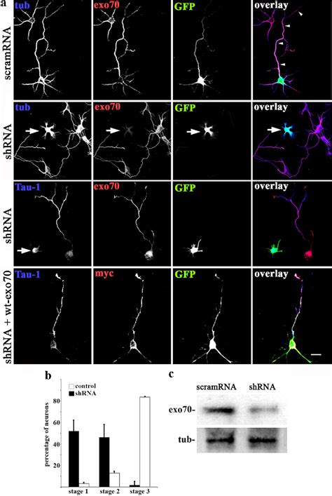 Figure 1 From The TC10Exo70 Complex Is Essential For Membrane