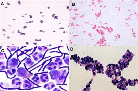 La Tinción De Gram Es La Técnica De Coloración Más Sencilla Y Más útil En Microbiología