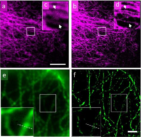 Images Of A Microtubule Network Of HeLa Cells Recorded Using Confocal