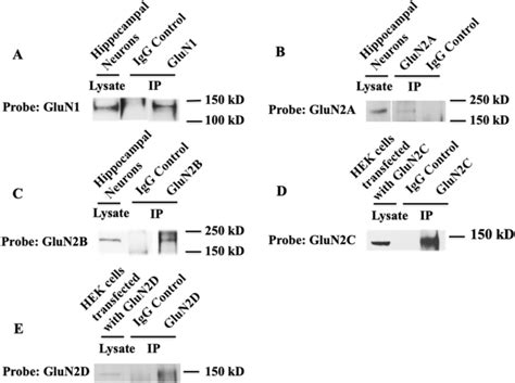 Functional Nmda Receptors Are Expressed By Human Pulmonary Artery