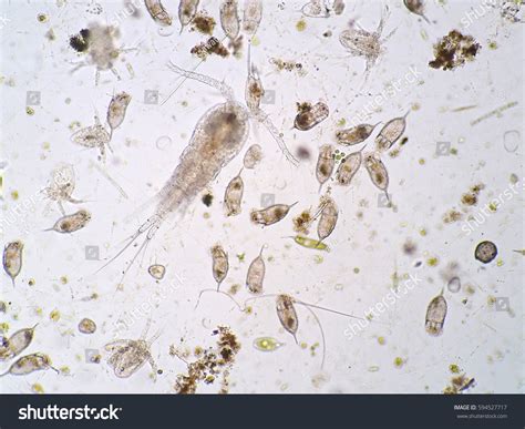 Freshwater Aquatic Plankton Under Microscope View Stock Photo 594527717 ...