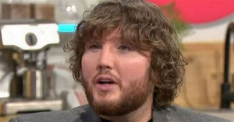 James Arthur Looks Unrecognisable In ITV Lorraine Appearance