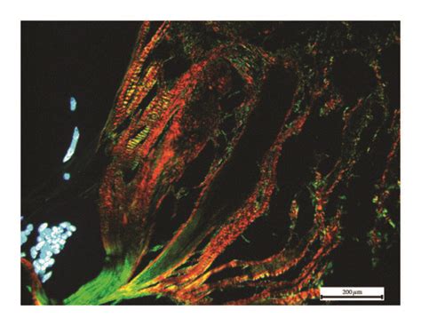 He Staining A D Masson Staining E H And Sirius Red Staining I L Download Scientific