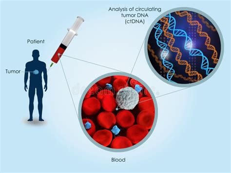 Circulating Tumor Dna Stock Illustration Illustration Of Immune