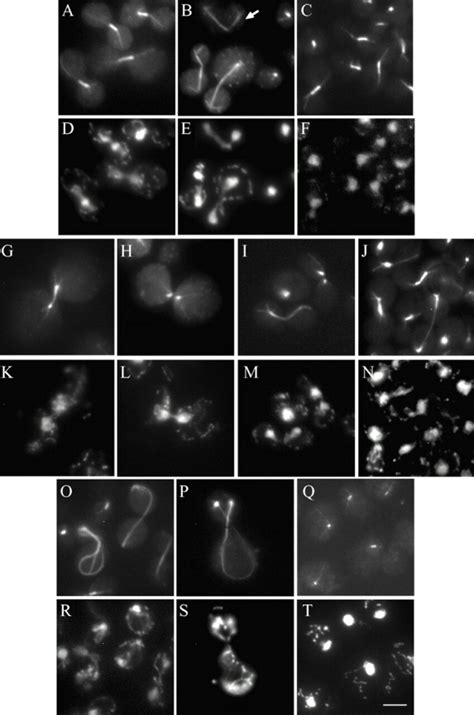 Duo1 And Dam1 Mutants Display Diverse Spindle Defects Ac Gj And