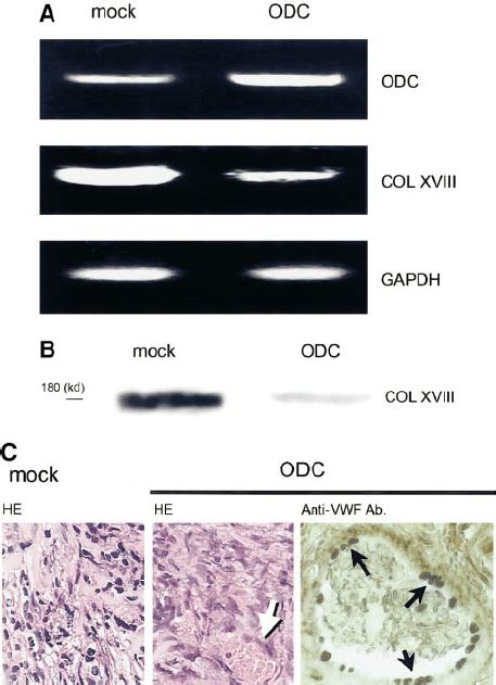 In Vivo Effects Of Odc Overexpression On Type Xviii Collagen Expression