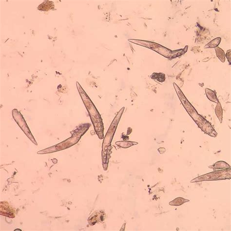 Demodex Milben Bei Hunden Kommen H Ufig Vor