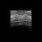 Clinical Software Rivent ContextVision For Ultrasound Imaging