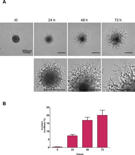 D Spheroid Invasion Assay Creative Bioarray Cellassay