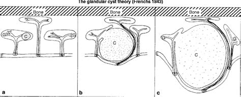 Pathogenesis And Pathophysiology Of Nasal Polyps Springerlink