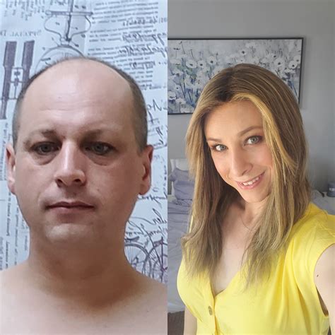 Mtf Transition Male To Female Transgender Transgender Mtf Mtf Hrt