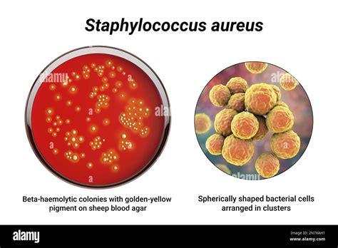 Bacteria Staphylococcus Aureus Colonies On Sheep Blood Agar Medium And