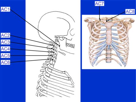 Glover Cervical Tender Points Flashcards Quizlet