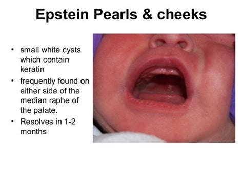 Neonatal Examination