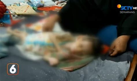 Berat Badan Hanya Kg Begini Nasib Pilu Balita Di Brebes Penderita