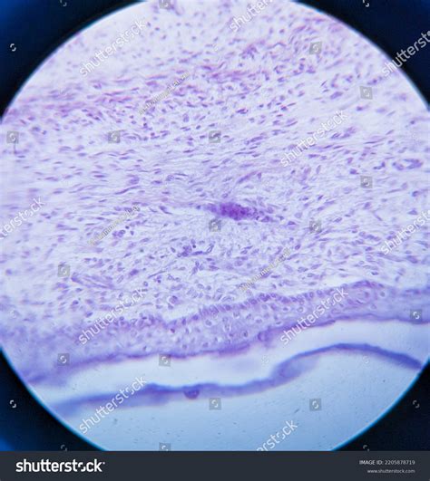 photo cartilage bone tissue  microscope stock photo